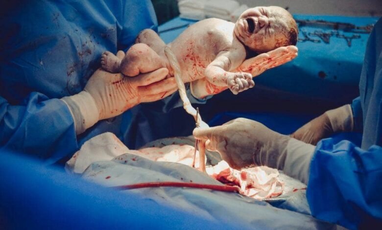 birth injuries
