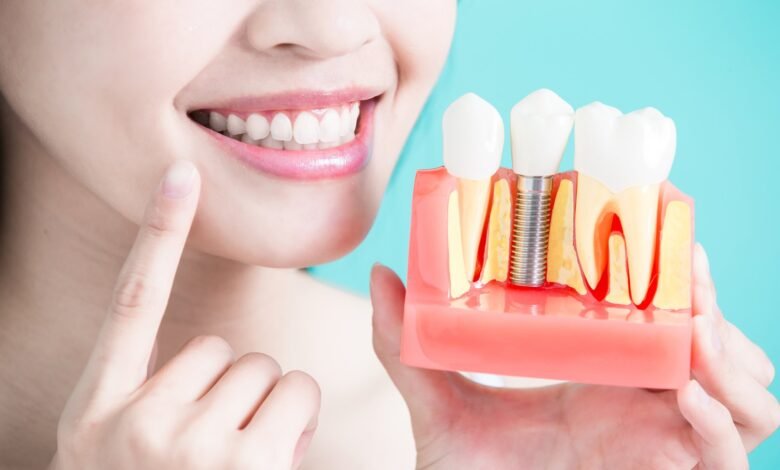 dental implant providers