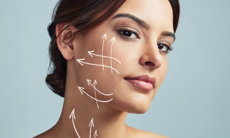 facelift