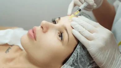 SRT Treatment