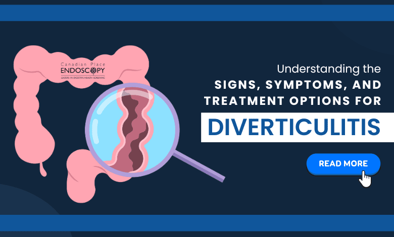 Diverticulitis