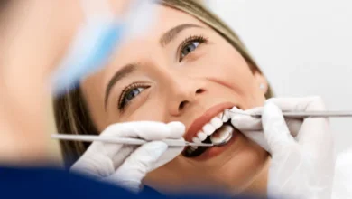 dental consultation