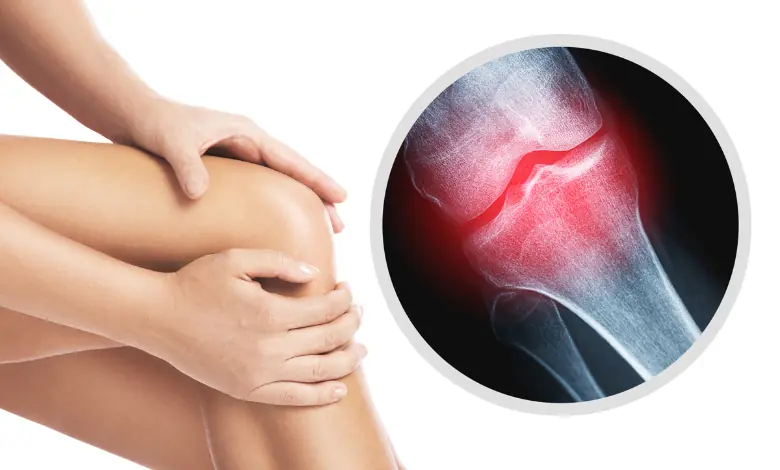 chronic joint pain