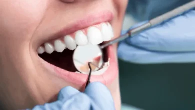 dental issues