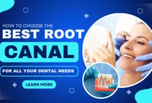 Best Root Canal