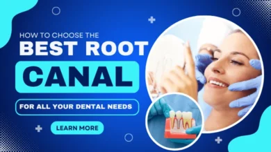 Best Root Canal