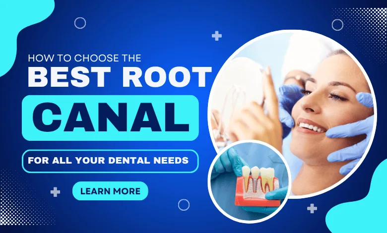 Best Root Canal