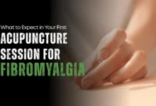 acupuncture for fibromyalgia
