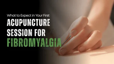 acupuncture for fibromyalgia