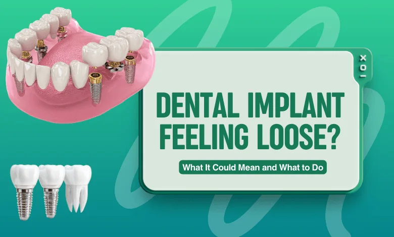 Dental Implant Feeling Loose? What It Could Mean and What to Do